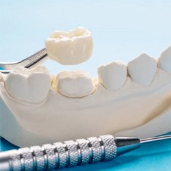 Model of dental crown