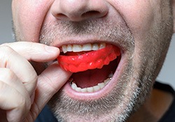 Man removing a mouthguard from his mouth