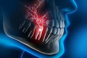 Diagram of person with a dental emergency in Fort Worth