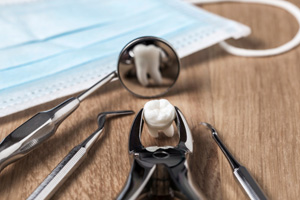 Extracted tooth held by forceps reflected in dental mirror