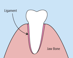 tooth extraction benbrook