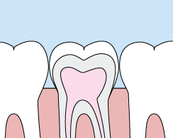 dental sealants - children's dentist 76132