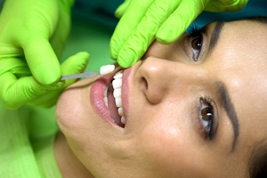 A woman having veneers placed