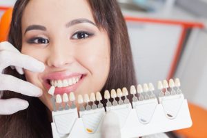 woman smiling posing with porcelain veneers