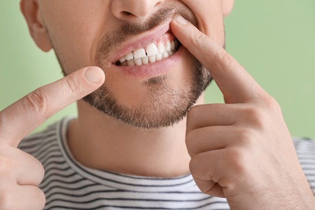 Man pointing to his gums.